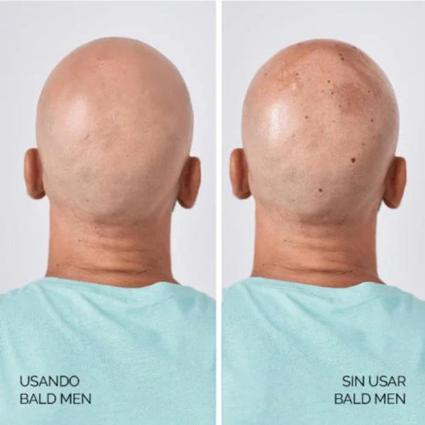Soivre Hair Bald Men 50+, 100 ml